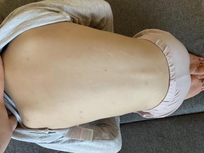 Předškoláček (3 až 6 let) | Neštovice a prochazka+maminka