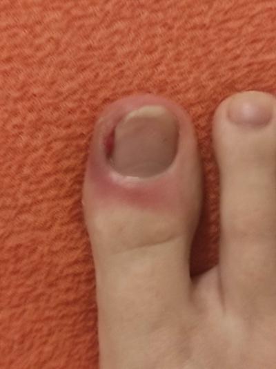 Zdravotní potíže dospělých | Mám jít s tímhle k doktorovi?