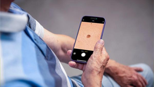 Aplikace SkinVision dokáže s 95% přesností identifikovat příznaky nejběžnějších typů rakoviny kůže.