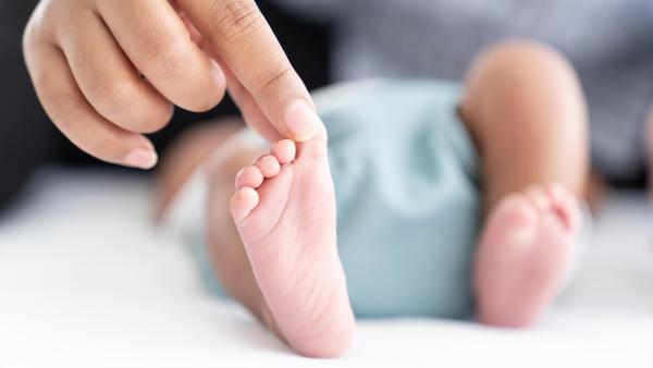 Babinského reflex poznáme podle roztažení prstů nohy při dráždění chodidla.