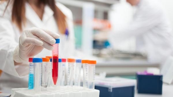 Pokud máte podezření, vždy je lepší podstoupit test na syfilis z krve.
