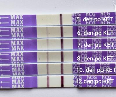 Centra asistované reprodukce | První IVF start listopad 2024
