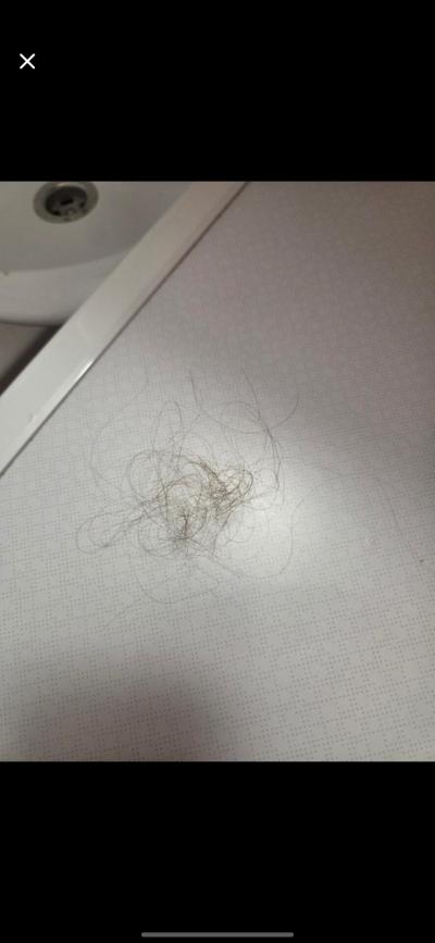 Kosmetika a hygienické potřeby | Vlasy padání je to hodne?