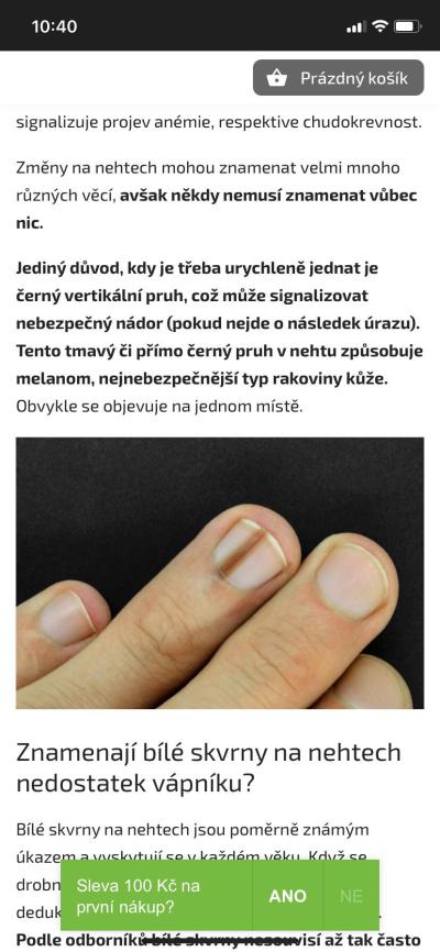 Dětské nemoci | Hnědá čárka na nehtu