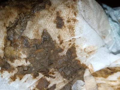 Alergie a ekzémy | Hlen a krev ve stolici kojence - dieta bez efektu