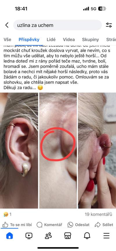 Zdravotní potíže dospělých | Uzlina za ????