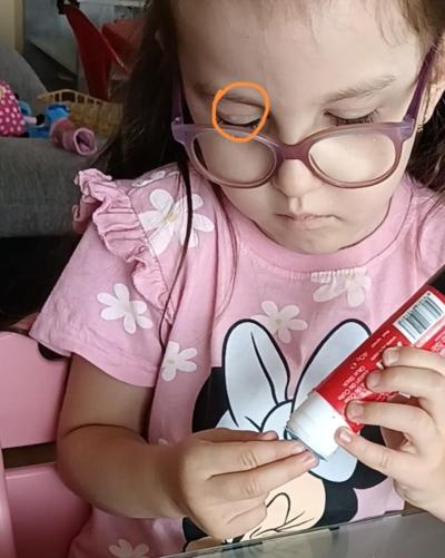 Předškoláček (3 až 6 let) | Dcera má boulicku na víčku