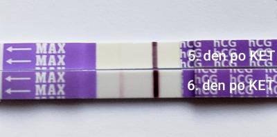 Centra asistované reprodukce | IVF/KET 2025