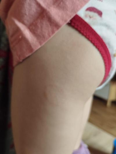 Zdravotní potíže dospělých | Bolerioza?
