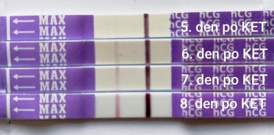 Centra asistované reprodukce | První IVF start listopad 2024