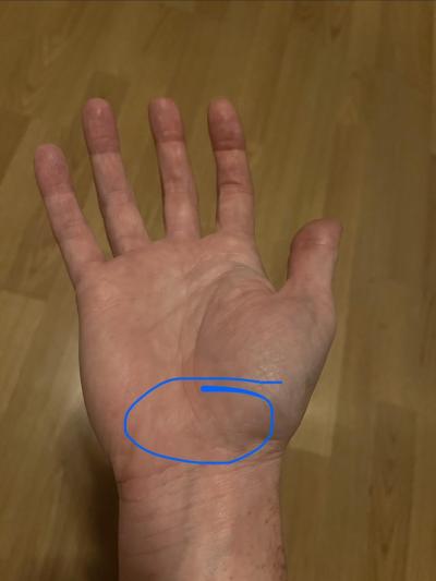Zdravotní potíže dospělých | Svědění kořene dlaně