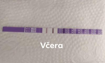 Testování a těhotenský test | KET DUBEN 2025