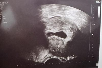 Centra asistované reprodukce | IVF/KET 2025