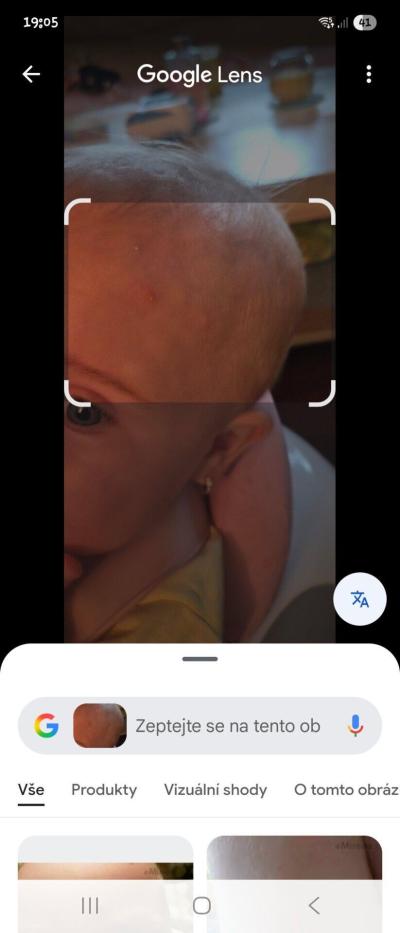 Dětské nemoci | Pupinky u 9 měsíční dcery