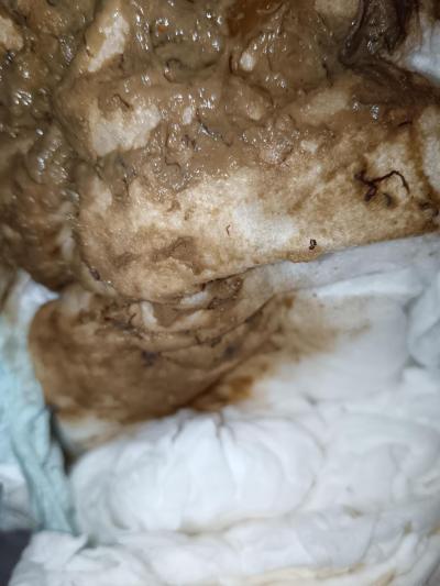 Alergie a ekzémy | Hlen a krev ve stolici kojence - dieta bez efektu