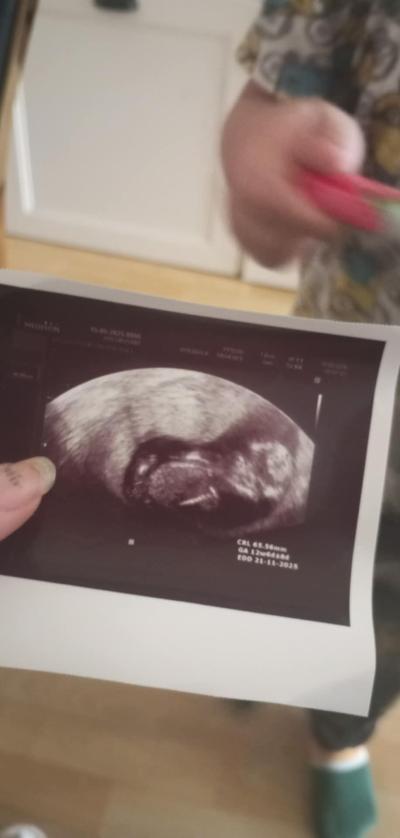 Těhotenství | Holka nebo kluk? 12tt