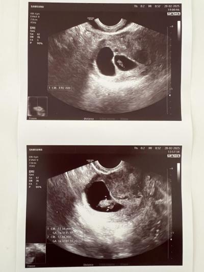 Centra asistované reprodukce | IVF/KET 2025