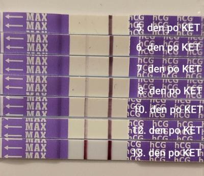 Centra asistované reprodukce | První IVF start listopad 2024