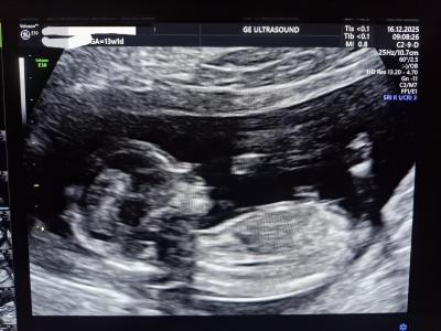 Centra asistované reprodukce | IVF/KET 2025