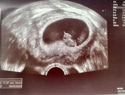 Centra asistované reprodukce | IVF/KET 2025