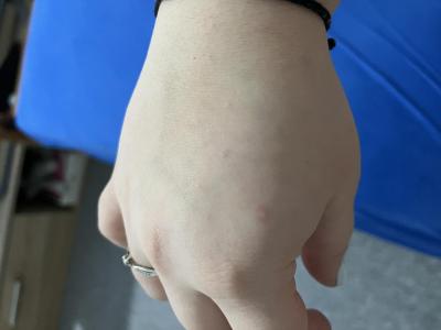 Zdravotní potíže dospělých | Vyrážka v těhotenství 24tt
