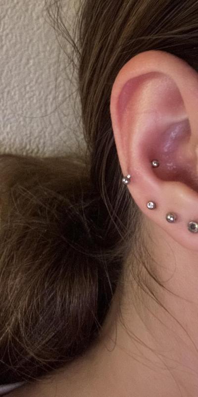 Zdravotní potíže dospělých | Piercing v uchu - špatné hojení