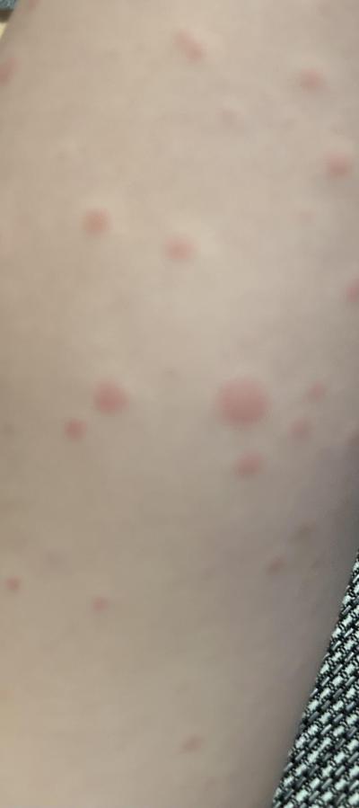 Dětské nemoci | Pozna te to?