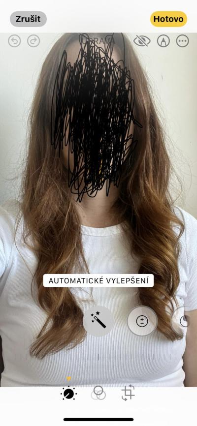 Zdravotní potíže dospělých | Vlasy jako Hanychová
