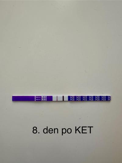 Centra asistované reprodukce | KET únor 2025
