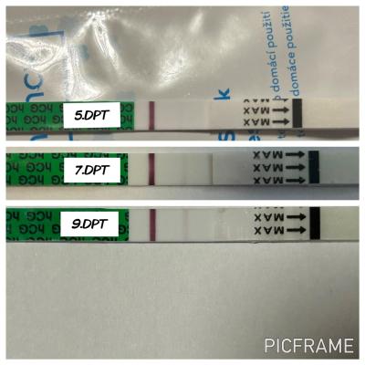 Centra asistované reprodukce | IVF/KET 2025