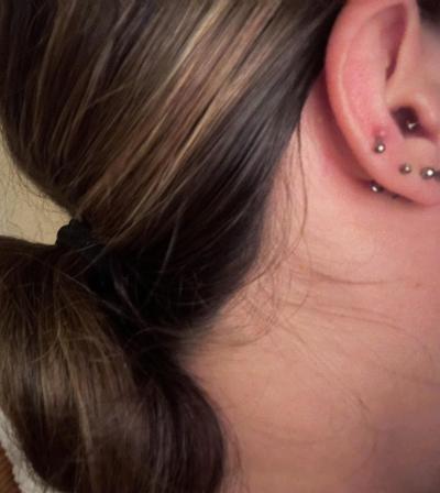 Zdravotní potíže dospělých | Piercing v uchu - špatné hojení