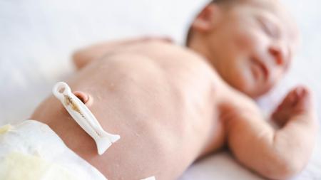 Neuvěřitelný příběh z Indie: Novorozená dívka měla uvnitř těla částečně vyvinuté dvojče