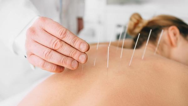 Akupunktura se využívá nejen k léčbě neplodnosti, ale i mírnění příznaků endometriózy.