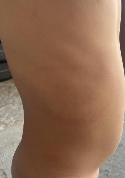 Dětské nemoci | Počkat nebo pohotovost?