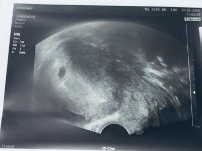 Centra asistované reprodukce | IVF/KET 2025