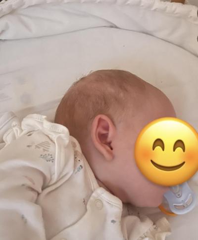 Dětské nemoci | Tvar hlavicky