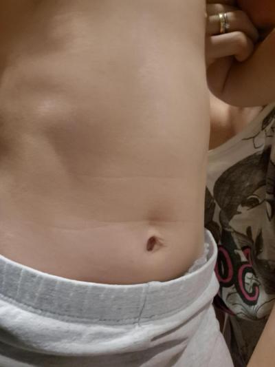 Dětské nemoci | 15m holcicka- dulek nad pupikem