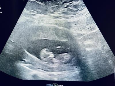 Centra asistované reprodukce | IVF/KET 2025