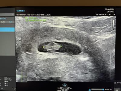 Centra asistované reprodukce | IVF/KET 2025